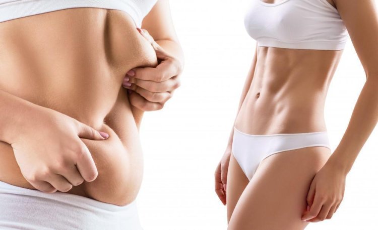 Diet & Exercise Not Worked Success Key Factors Liposuction in Dubai